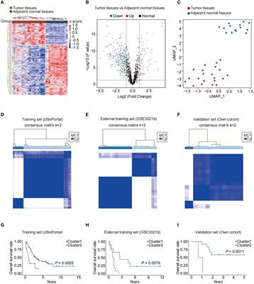 Nucleic acid-sensing-related gene signature in predicting prognosis and treatment efficiency of small cell lung cancer patients